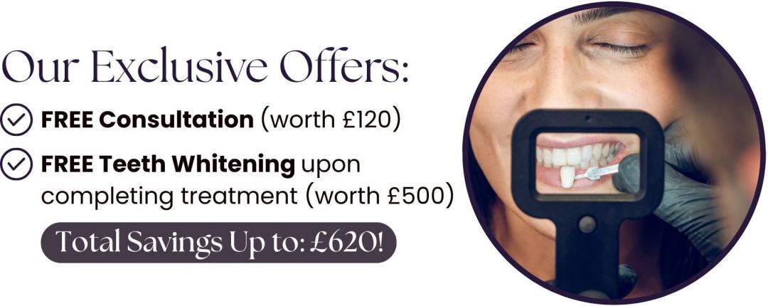 Join Us For Our Composite Bonding Event Friday 29th May 2026